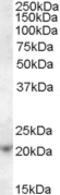 Anti-Silencing Function 1A Histone Chaperone antibody, orb19690, Biorbyt, Western Blot image 