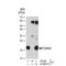 Translocase Of Outer Mitochondrial Membrane 20 antibody, GTX00773, GeneTex, Immunoprecipitation image 