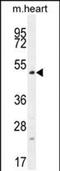 TSPY Like 4 antibody, PA5-48329, Invitrogen Antibodies, Western Blot image 