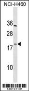 Platelet factor 4 variant antibody, 60-462, ProSci, Western Blot image 