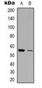 Solute Carrier Family 30 Member 1 antibody, orb318838, Biorbyt, Western Blot image 