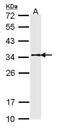 Tropomyosin 1 antibody, PA5-29846, Invitrogen Antibodies, Western Blot image 