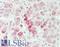 Carboxypeptidase M antibody, LS-B13763, Lifespan Biosciences, Immunohistochemistry paraffin image 