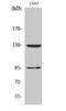 Gamma-Aminobutyric Acid Type B Receptor Subunit 1 antibody, STJ93193, St John
