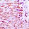 Kruppel Like Factor 10 antibody, orb256646, Biorbyt, Immunohistochemistry paraffin image 