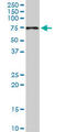 PDZ Domain Containing 1 antibody, LS-B6114, Lifespan Biosciences, Western Blot image 