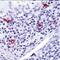 CD1a Molecule antibody, MA5-12526, Invitrogen Antibodies, Immunohistochemistry paraffin image 