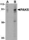 P21 (RAC1) Activated Kinase 5 antibody, MBS150669, MyBioSource, Western Blot image 