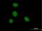 Zinc Finger And BTB Domain Containing 6 antibody, H00010773-B01P, Novus Biologicals, Immunocytochemistry image 