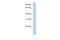 TGFB Induced Factor Homeobox 1 antibody, A04122, Boster Biological Technology, Western Blot image 