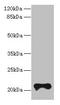 Transmembrane Protein 154 antibody, CSB-PA023729LA01HU, Cusabio, Western Blot image 