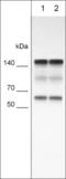 Integrin Subunit Alpha 5 antibody, IM5951, ECM Biosciences, Western Blot image 