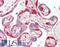 Protein Tyrosine Kinase 2 antibody, LS-B12417, Lifespan Biosciences, Immunohistochemistry paraffin image 