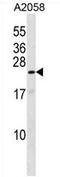 KRAB Box Domain Containing 4 antibody, AP54666PU-N, Origene, Western Blot image 