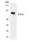 Ezrin antibody, LS-C291942, Lifespan Biosciences, Western Blot image 