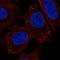 Transmembrane Protein 215 antibody, HPA063207, Atlas Antibodies, Immunofluorescence image 