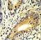 Family With Sequence Similarity 3 Member B antibody, LS-C166000, Lifespan Biosciences, Immunohistochemistry paraffin image 