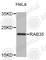 RAB35, Member RAS Oncogene Family antibody, A8030, ABclonal Technology, Western Blot image 