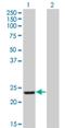 Recoverin antibody, H00005957-M03, Novus Biologicals, Western Blot image 