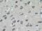 ARH1 antibody, 17911-1-AP, Proteintech Group, Immunohistochemistry paraffin image 