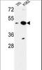 Nucleoporin 42 antibody, LS-C163081, Lifespan Biosciences, Western Blot image 