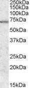 Methylenetetrahydrofolate Dehydrogenase (NADP+ Dependent) 2 Like antibody, 46-690, ProSci, Western Blot image 