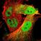 Cyclin Dependent Kinase 6 antibody, NBP1-87262, Novus Biologicals, Immunofluorescence image 