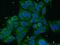 Long-chain-fatty-acid--CoA ligase 1 antibody, 13989-1-AP, Proteintech Group, Immunofluorescence image 