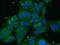 Acyl-CoA Synthetase Long Chain Family Member 1 antibody, 13989-1-AP, Proteintech Group, Immunofluorescence image 