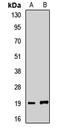 Gem Nuclear Organelle Associated Protein 6 antibody, LS-C668879, Lifespan Biosciences, Western Blot image 