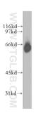 Gamma-Aminobutyric Acid Type A Receptor Alpha4 Subunit antibody, 12979-1-AP, Proteintech Group, Western Blot image 