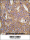 AsnRS antibody, 63-015, ProSci, Immunohistochemistry paraffin image 