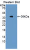 Hydroxysteroid 11-Beta Dehydrogenase 1 antibody, abx130034, Abbexa, Western Blot image 