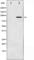 Component Of Inhibitor Of Nuclear Factor Kappa B Kinase Complex antibody, abx010970, Abbexa, Western Blot image 