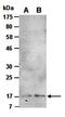 Helicase, Lymphoid Specific antibody, orb66741, Biorbyt, Western Blot image 