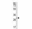 Snail Family Transcriptional Repressor 1 antibody, F51295-0.4ML, NSJ Bioreagents, Western Blot image 