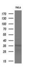 Monoglyceride Lipase antibody, NBP2-00735, Novus Biologicals, Western Blot image 