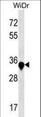 Alport Syndrome, Mental Retardation, Midface Hypoplasia And Elliptocytosis Chromosomal Region Gene 1 antibody, LS-C161052, Lifespan Biosciences, Western Blot image 