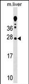 T Cell Receptor Associated Transmembrane Adaptor 1 antibody, PA5-71984, Invitrogen Antibodies, Western Blot image 