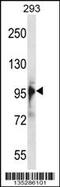 RNA Binding Motif Protein 10 antibody, 58-229, ProSci, Western Blot image 