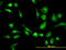 Carboxypeptidase Vitellogenic Like antibody, LS-B4528, Lifespan Biosciences, Immunofluorescence image 