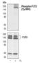 Fms Related Tyrosine Kinase 3 antibody, MA5-14961, Invitrogen Antibodies, Western Blot image 