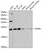 Cytidine/Uridine Monophosphate Kinase 1 antibody, GTX33102, GeneTex, Western Blot image 