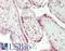 Ig kappa-b4 chain C region antibody, LS-B14163, Lifespan Biosciences, Immunohistochemistry paraffin image 