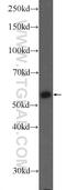 Pyruvate Kinase M1/2 antibody, 25659-1-AP, Proteintech Group, Western Blot image 