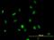 Histone Deacetylase 1 antibody, H00003065-M06, Novus Biologicals, Immunofluorescence image 