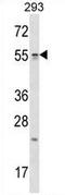 Tetratricopeptide Repeat Domain 23 antibody, AP54394PU-N, Origene, Western Blot image 