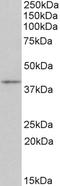 CD28 antibody, EB10741, Everest Biotech, Western Blot image 
