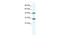 DExD-Box Helicase 39A antibody, 28-489, ProSci, Western Blot image 