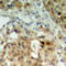 Heterogeneous Nuclear Ribonucleoprotein K antibody, LS-C359018, Lifespan Biosciences, Immunohistochemistry paraffin image 